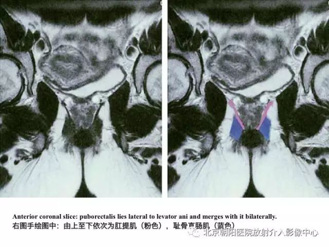 qw44.jpg