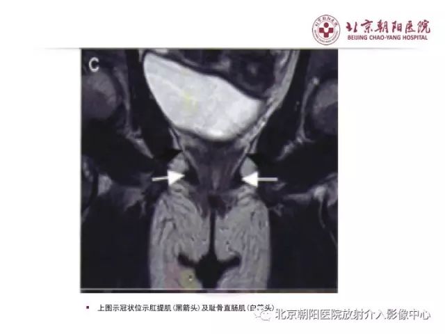 qw45.jpg