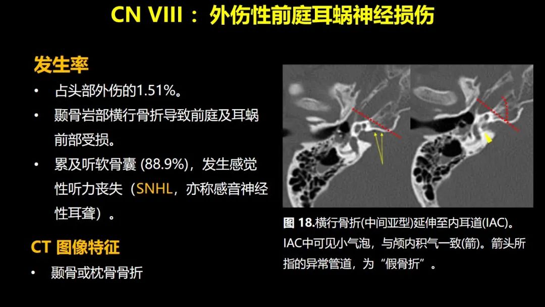 qw22.jpg