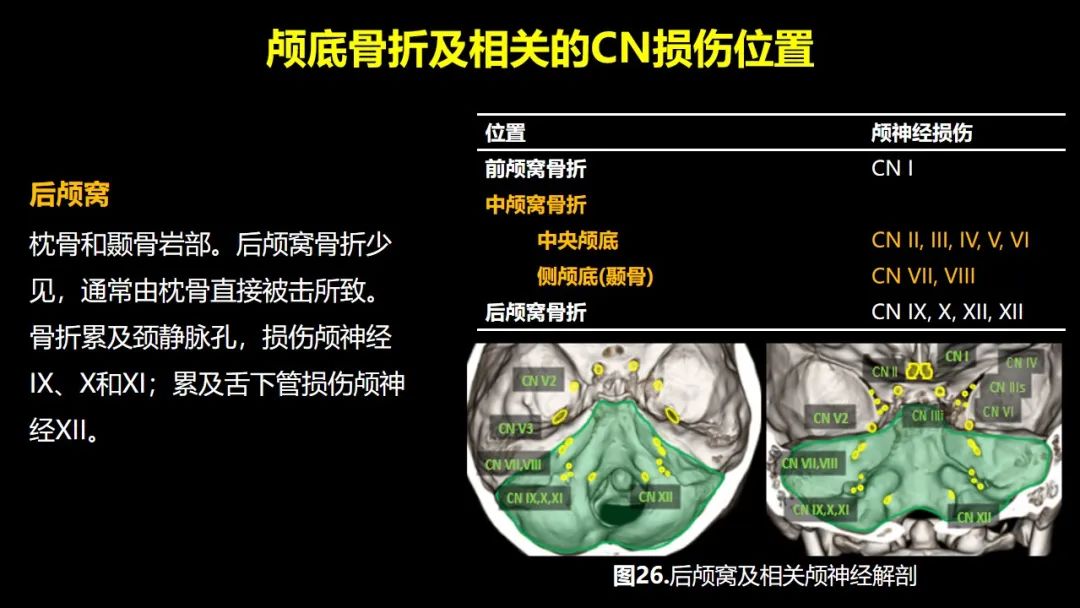 qw29.jpg