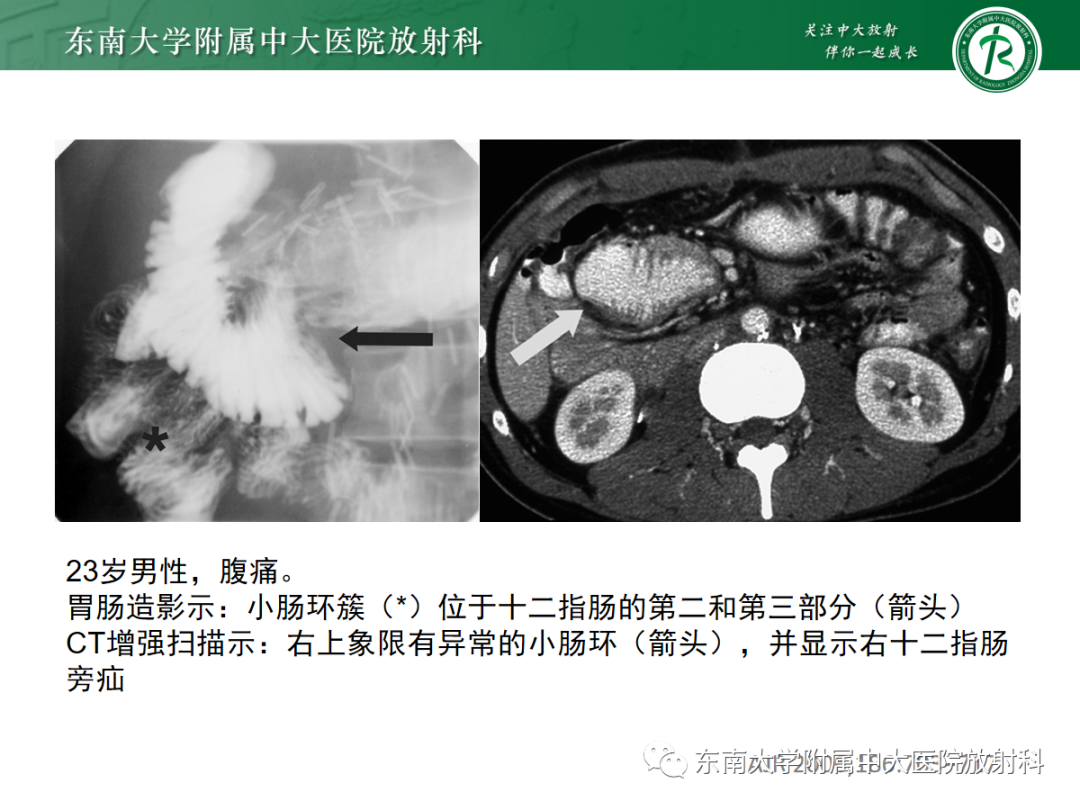 yxppt-2021-05-31_11-58-44_666961.png