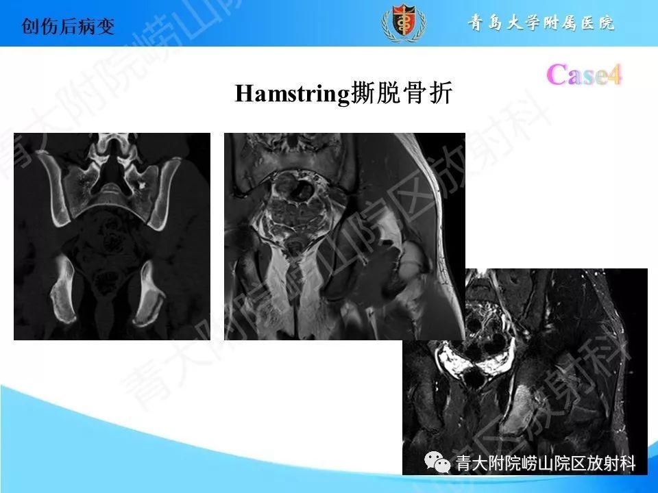 173ff74ecd564d5996b17fd052dd9ab6.jpeg