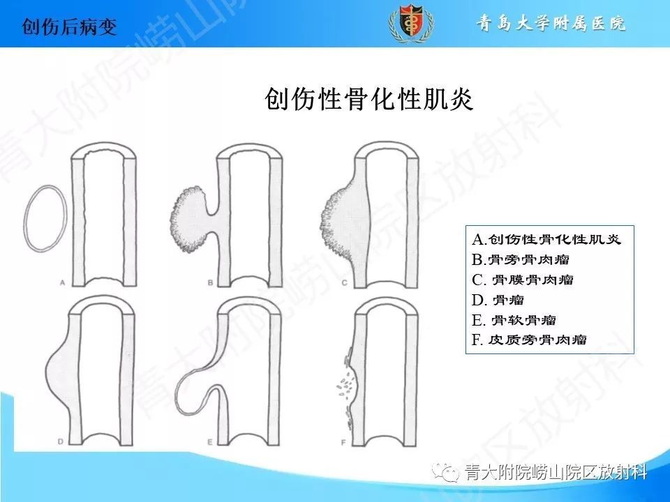 aa36d64994b145218f5a2f6fa60f326d.jpeg