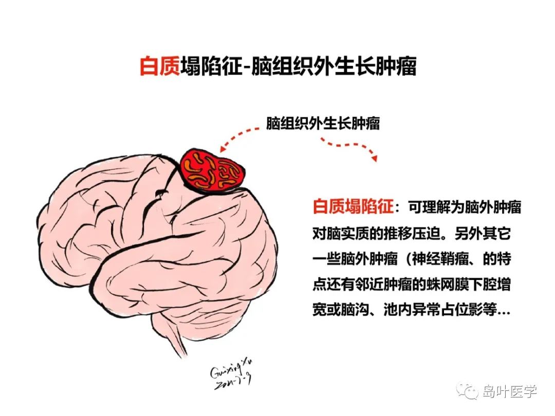 qw35.jpg