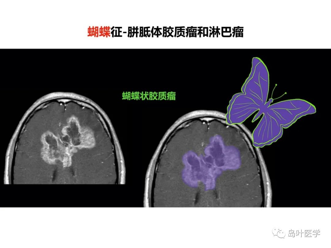 qw56.jpg