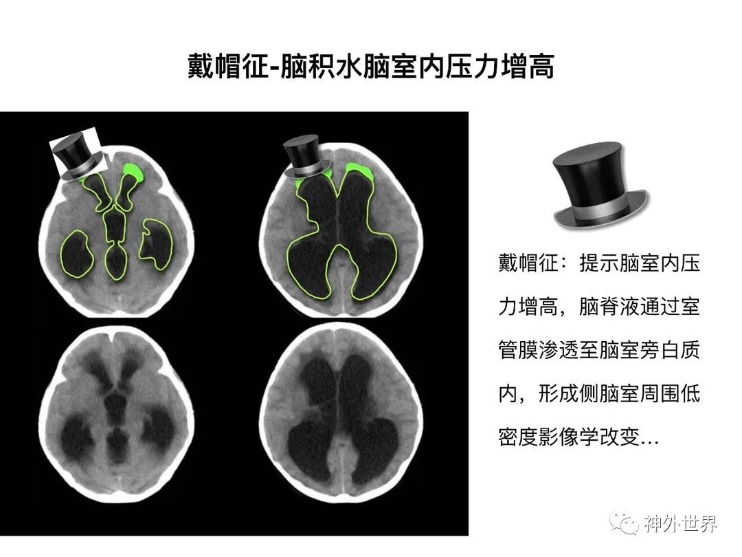 qw36.jpg