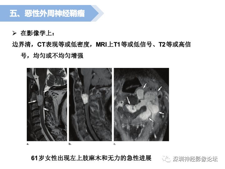 qw23.jpg