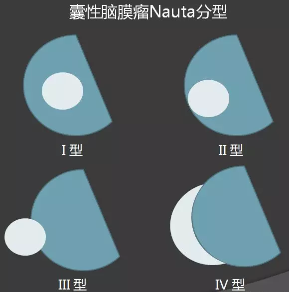 qw20.jpg