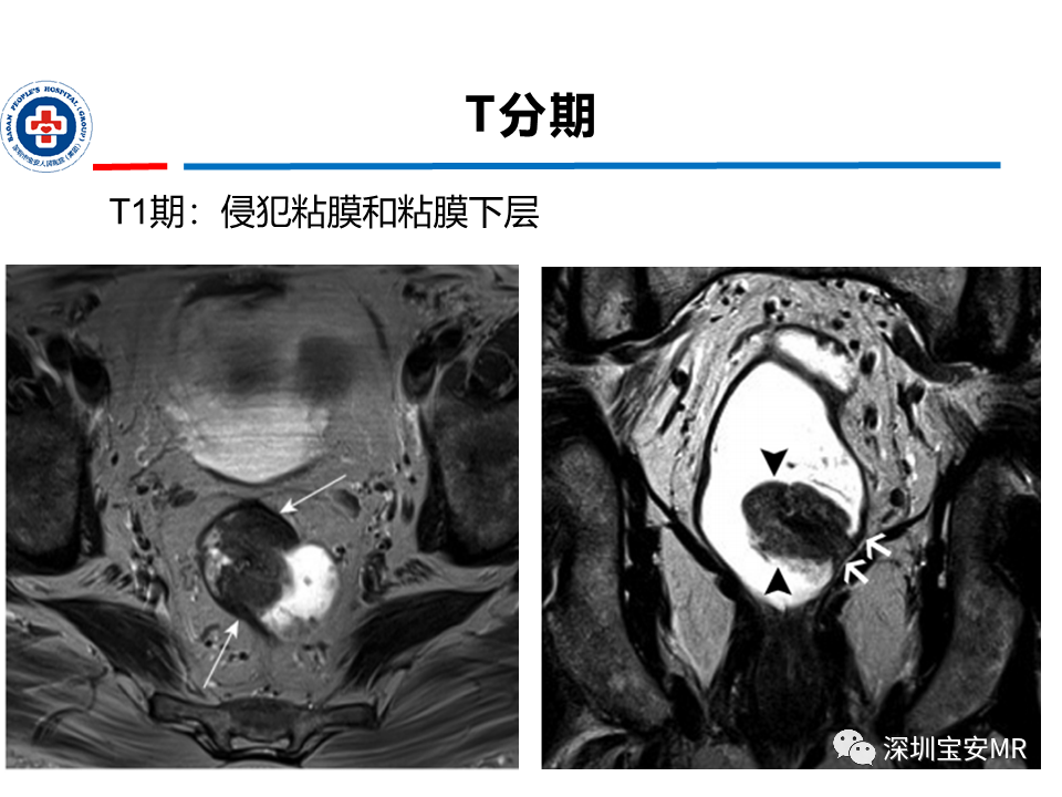 baf6b28aedcd0eeac09019a4ddd43a5a.png