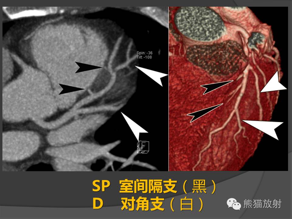 ccbb20c1681cf1cd38007282f7dfe94b.jpg