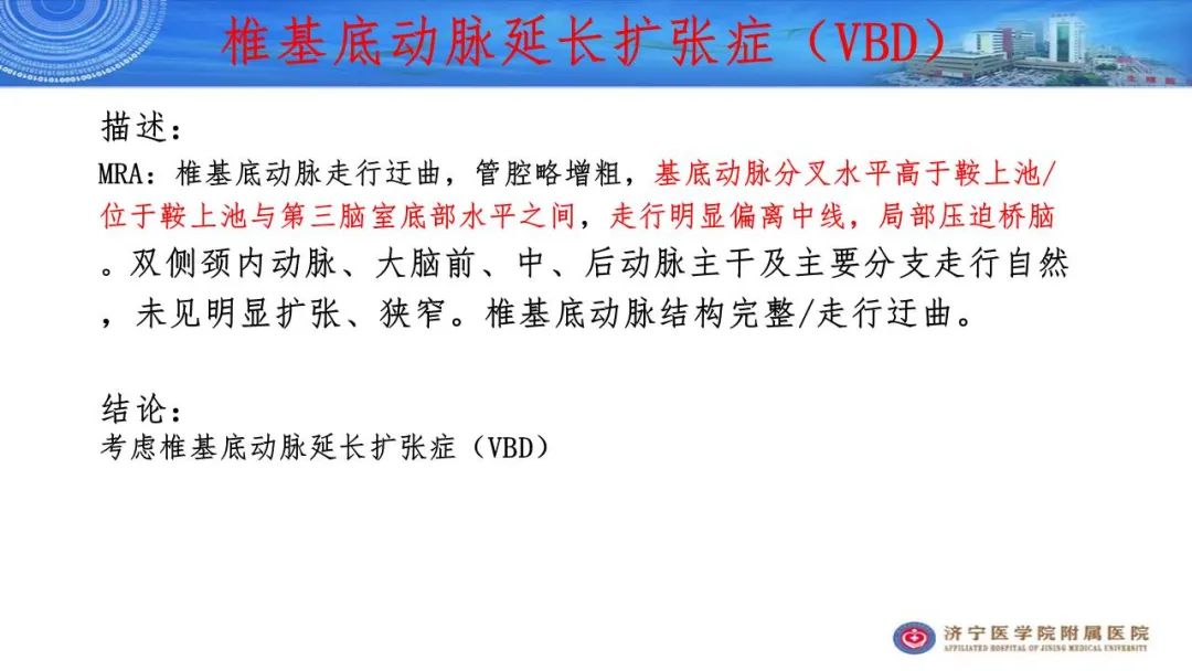 ff1cd90d3e92a36892f90cd856b6caaa.jpg