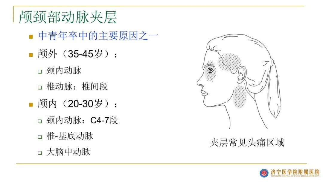 abf3c15d1c1b4534ed16a8165cde2b6e.jpg