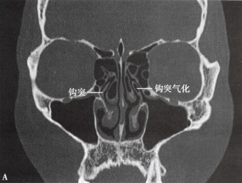 a9cd30aa38ef76b0437fa5af6a412bb6.jpg
