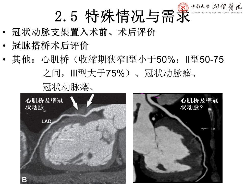 qw29.jpg