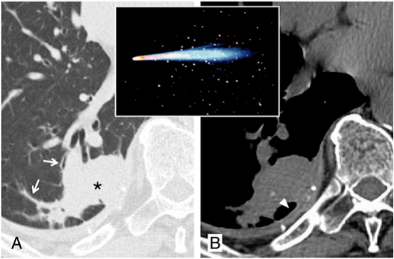 dce00208b37f44aebf12947a59599f33.png
