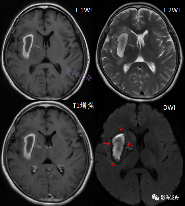 8ee1519cdd2c701aaa6ddc65e892d34a.png
