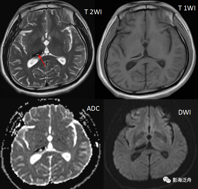 fe23674187cc9e3df11b93537d5f1afb.png