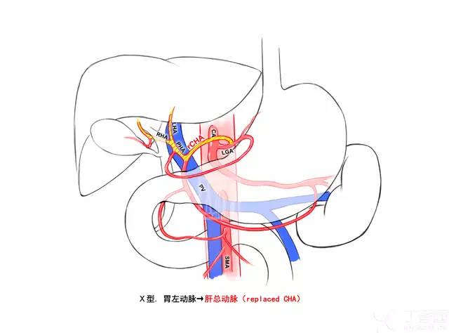 c49b195a02eb408726d159123ccf16fa.jpg