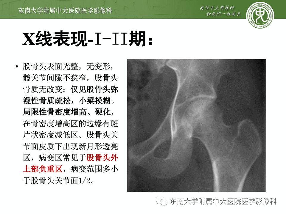 9374eb3daf1209d35a46f638d2a6bb98.png