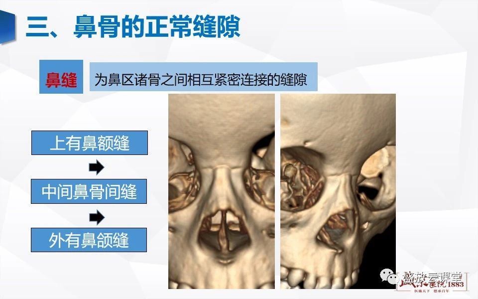 042ce6cd25fb35871e1082c525d5ee68.jpg
