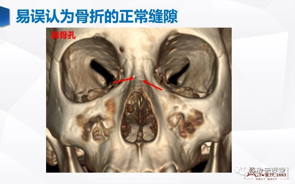 cac35fda6520504191593e48db85a00d.jpg