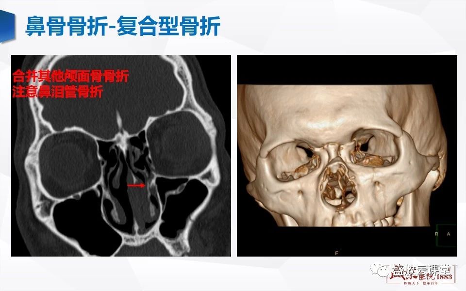 61c0738cad3aba0fa0104a3a262f80b0.jpg