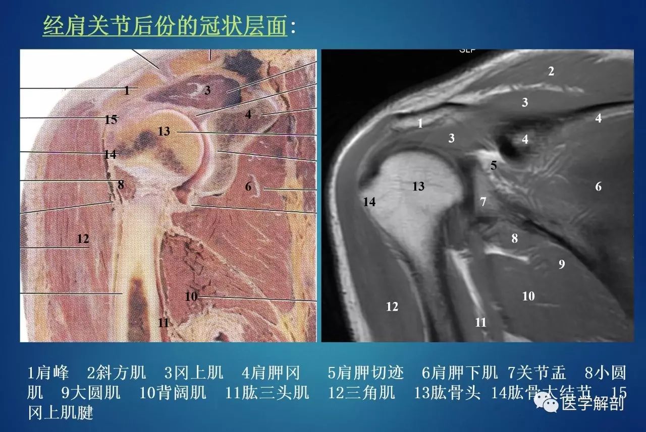 最详细肩胸部拉伸教程 - 知乎