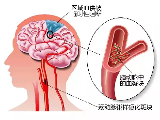 ab02a37c8fca7f29d50b928f5ec31e3f.png