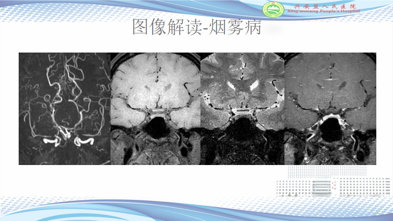 f1857a0e40939a686c44ea7491d53804.png