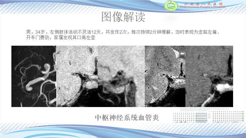 e972dee0ed6c75b090baf3ca9323d70f.png