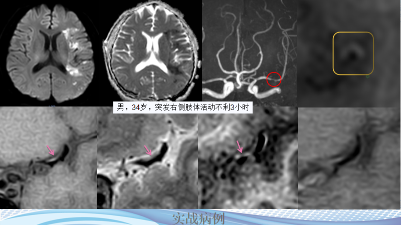 111bfc5163dca186ecb6c87b600a1ff1.png