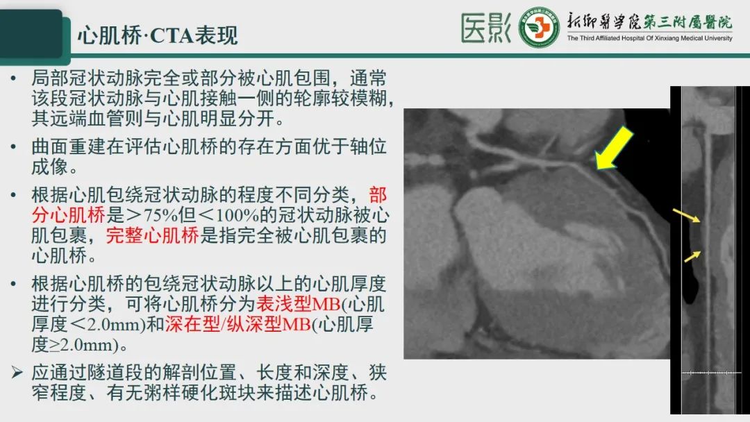 eec60c50605b5a995a62b429e38eb4ff.jpg