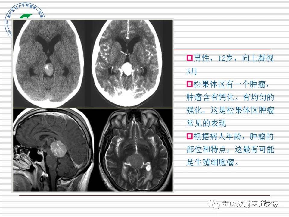 0fca61467a9218127a3a201c91ca4da5.jpg