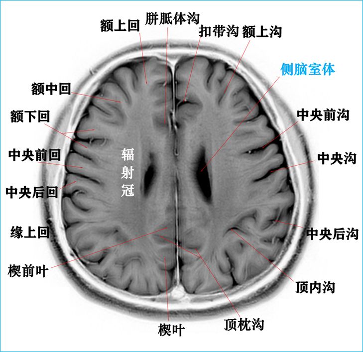 qw10.jpg