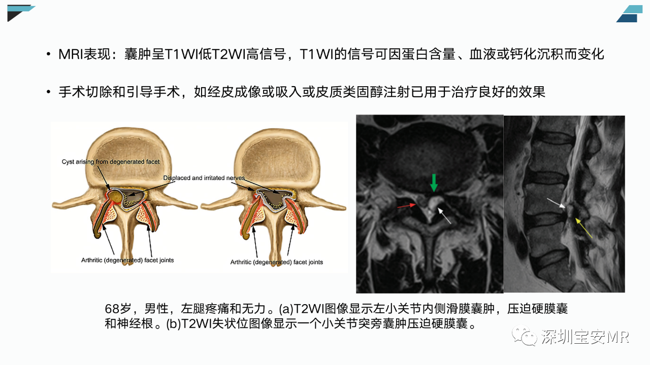 7843c230469e4fa5a1e2601054a32464.png