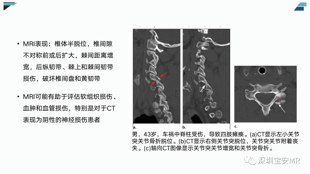 eb9d4368f215c4cef0899d804adfada7.png