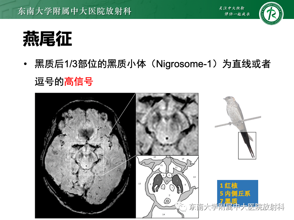 64c58991ed04c4b7d23fe312fe86dfa2.png