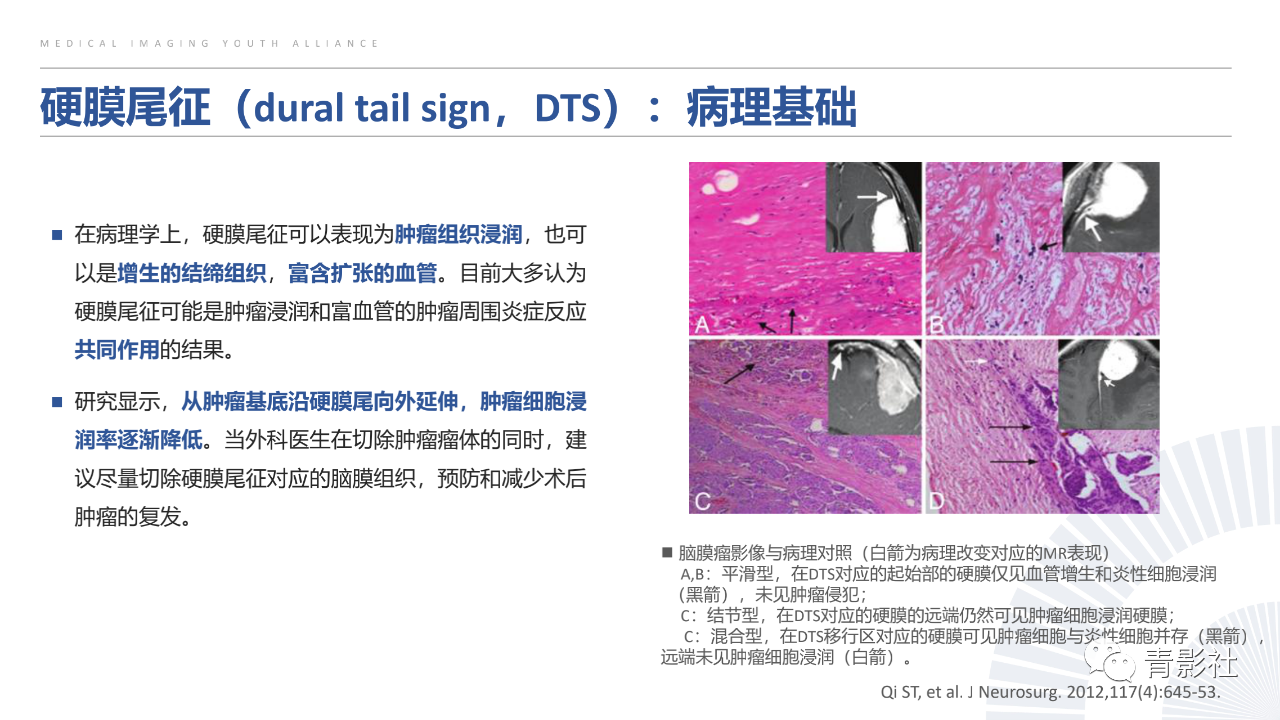42d2b7910b4bdc909fb50f1663a446f5.png