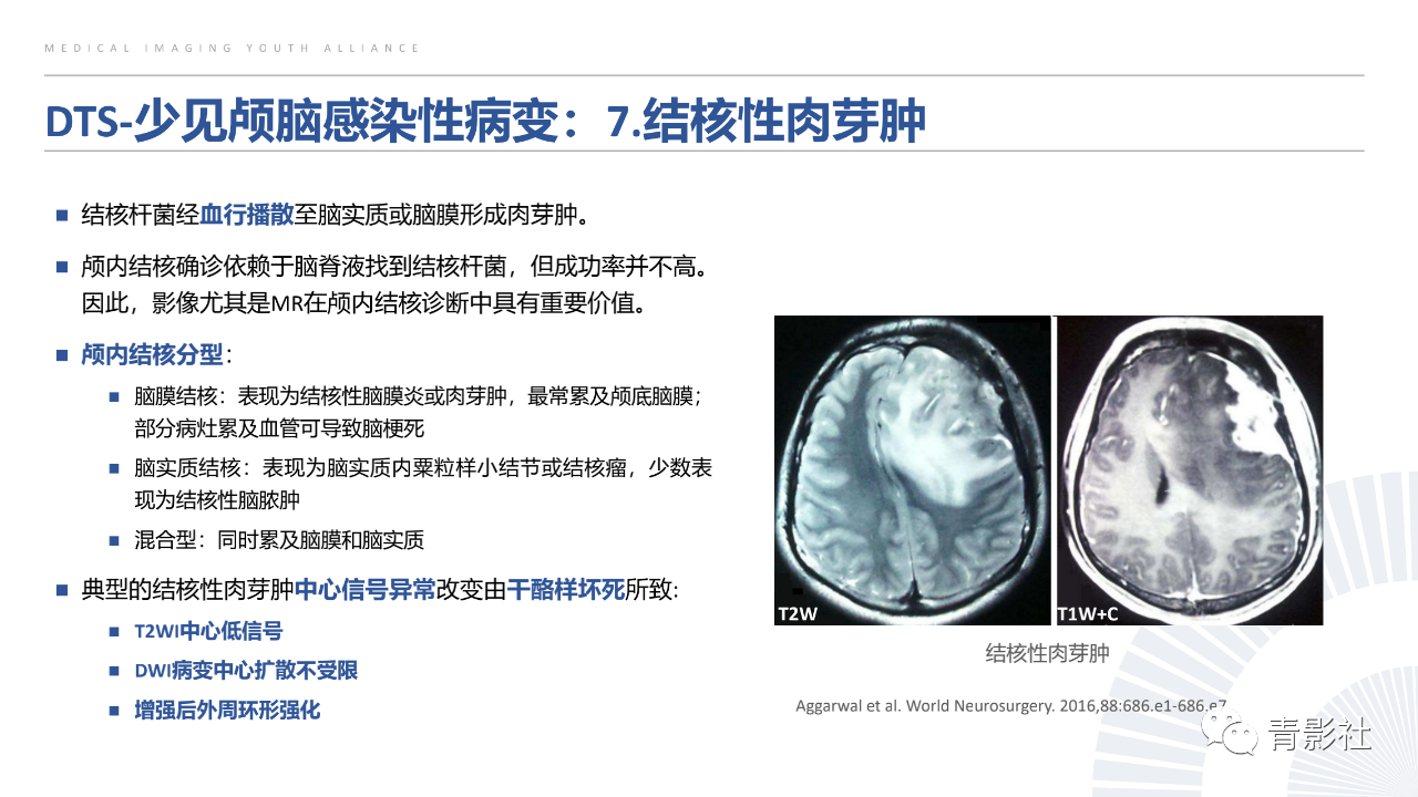 bfac79a41226a28ae5bf1fe70cf14a9e.png