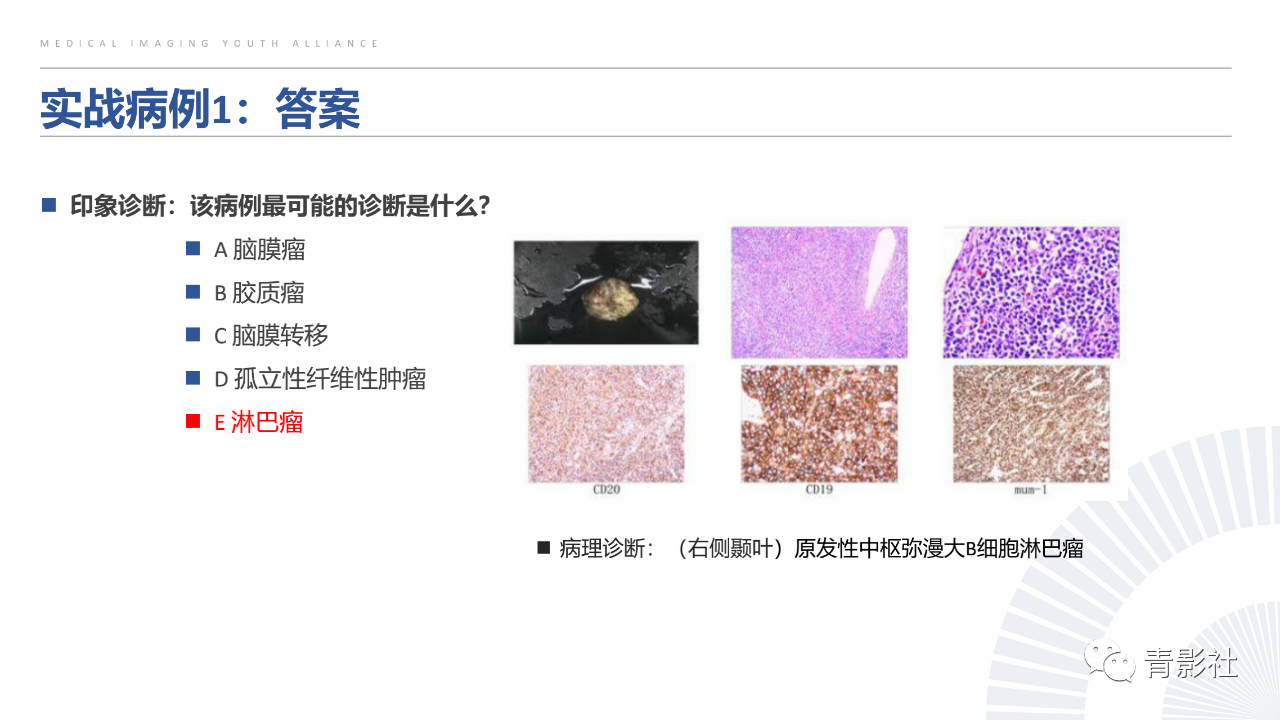 7853f4a131c4570c3015c1fc5a94d5d2.png