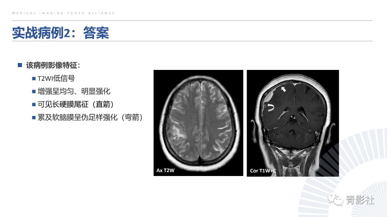 87b44ef26cdb5a1beec80cac4a8ad837.png