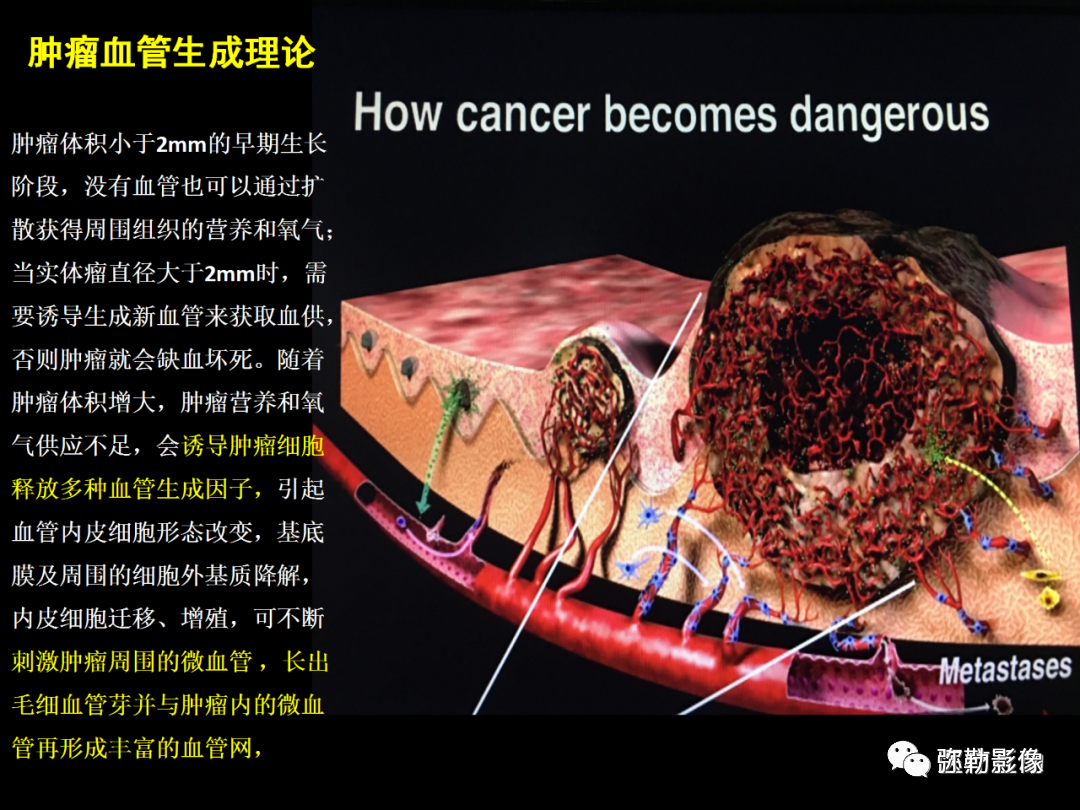 ff2fff2066dd45ca0ddf3196a8eb1e2c.png