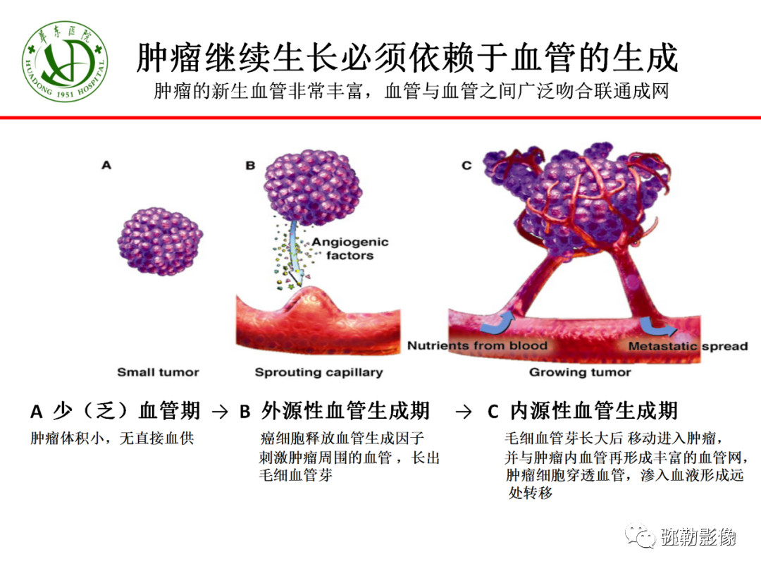 17ee09558f4703971f0f2518f28cb71e.png