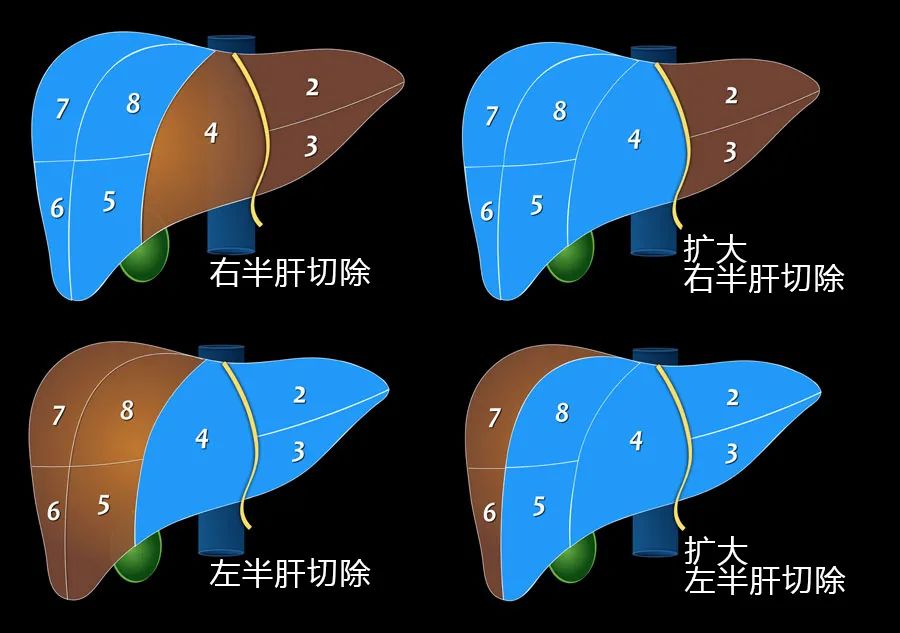 0c5d264228fe9784acd7830fe4949296.jpg
