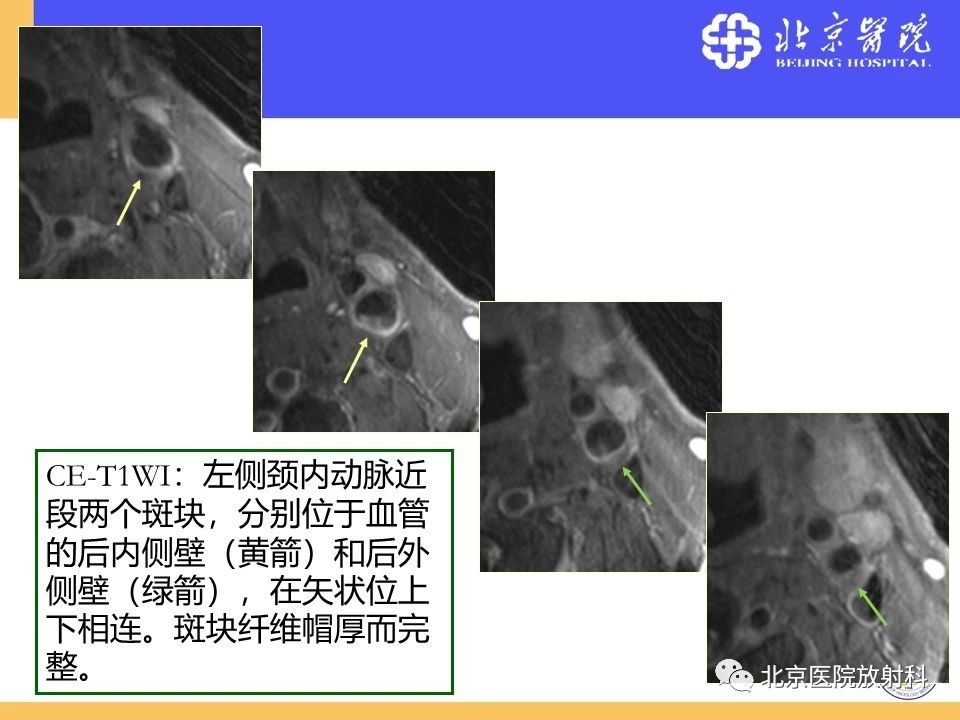 a197a31199fcd75e35afd0e53e795055.jpg