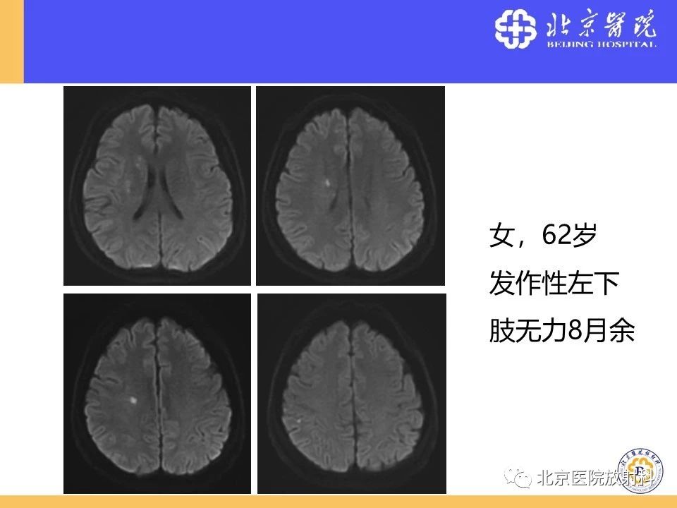 fa9d854d647bac9be855de380c596ced.jpg