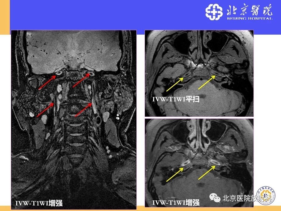 a4850dcb1cebd4351f57bd6fe99cb457.jpg