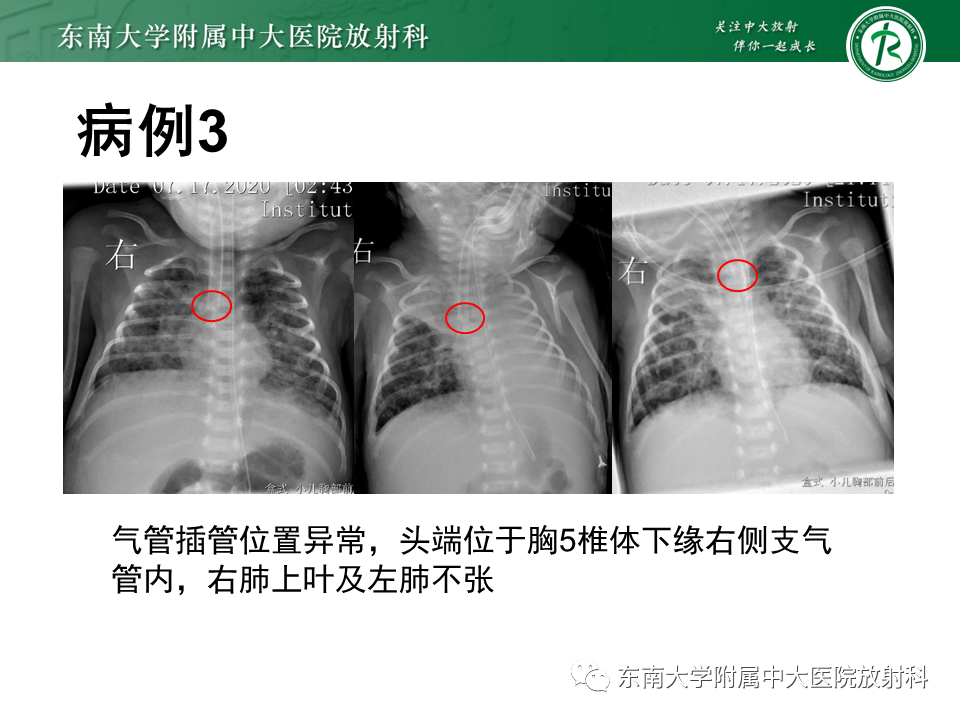 b607b877db639790b075632b98bb4810.png
