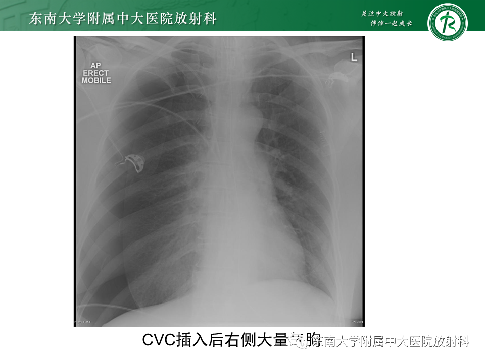 cfed0b33054de436085c7f50639bedb0.png