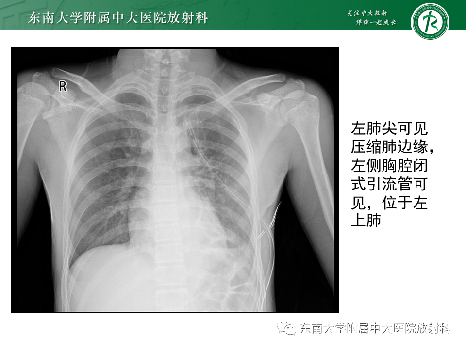 a7ccde2cf9a07526401c5e93f49f71d9.png